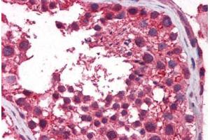 Immunohistochemistry (Formalin-fixed Paraffin-embedded Sections) (IHC (fp)) image for anti-Telomeric Repeat Binding Factor 2, Interacting Protein (TERF2IP) (AA 142-191) antibody (ABIN6747199)