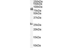 Image no. 1 for anti-Chromodomain Protein, Y-Like (CDYL) (C-Term) antibody (ABIN374294) (CDYL 抗体  (C-Term))