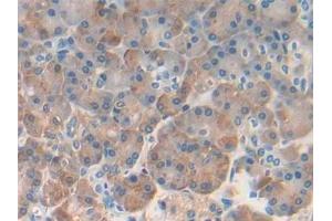 Detection of REG1b in Human Pancreas Tissue using Polyclonal Antibody to Regenerating Islet Derived Protein 1 Beta (REG1b) (REG1B 抗体  (AA 23-166))