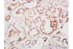 Formalin-fixed and paraffin embedded human kindey labeled with Rabbit Anti-Calmodulin/CaM I Polyclonal Antibody, Unconjugated 1:200 followed by conjugation to the secondary antibody and DAB staining (Calmodulin 1 抗体  (AA 81-152))