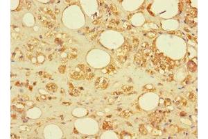 Immunohistochemistry of paraffin-embedded human adrenal gland tissue using ABIN7170737 at dilution of 1:100 (SAMD12 抗体  (AA 1-201))