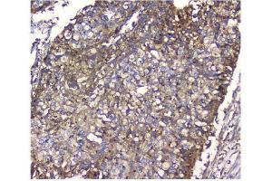 IHC analysis of NMI using anti-NMI antibody (ABIN3043451).