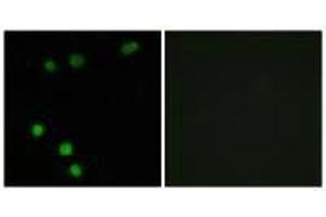 Immunofluorescence analysis of MCF-7 cells, using TP53INP2 antibody. (TP53INP2 抗体)