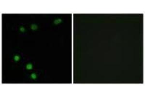 Immunofluorescence analysis of MCF-7 cells, using TP53INP2 antibody.