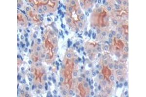 IHC-P analysis of Mouse Tissue, with DAB staining. (PCSK9 抗体  (AA 156-694))