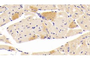 Detection of CGRP in Mouse Cardiac Muscle Tissue using Polyclonal Antibody to Calcitonin Gene Related Peptide (CGRP) (CGRP 抗体  (AA 1-130))