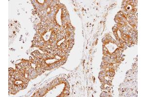 IHC-P Image Immunohistochemical analysis of paraffin-embedded human endo mitrial, using CCNDBP1, antibody at 1:100 dilution. (CCNDBP1 抗体  (C-Term))