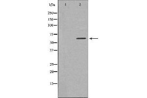 Western blot analysis of extracts from HeLa cells, using TBC1D3 antibody.