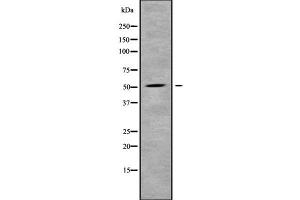Western blot analysis SLC2A2 using Jurkat whole cell lysates (SLC2A2 抗体  (N-Term))