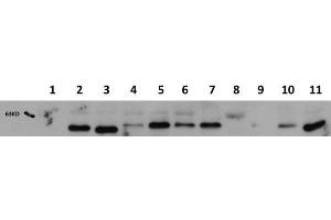 Western Blotting (WB) image for anti-V-Akt Murine Thymoma Viral Oncogene Homolog 1 (AKT1) (Internal Region) antibody (ABIN1607685)