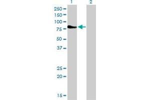 Western Blot analysis of DMPK expression in transfected 293T cell line by DMPK monoclonal antibody (M01), clone 2F7. (DMPK 抗体  (AA 303-420))