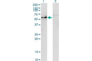 Western Blot analysis of ANGPTL3 expression in transfected 293T cell line by ANGPTL3 monoclonal antibody (M01), clone 3B7. (ANGPTL3 抗体  (AA 17-460))