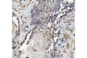 IHC analysis of MMP2 using anti-MMP2 antibody (ABIN7601677).
