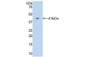 Detection of Recombinant VCC1, Human using Polyclonal Antibody to VEGF Co Regulated Chemokine 1 (VCC1) (CXCL17 抗体  (AA 24-119))
