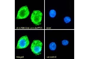 Immunofluorescence (IF) image for anti-Formiminotransferase Cyclodeaminase (FTCD) (N-Term) antibody (ABIN185267)