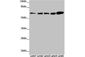 Western blot All lanes: ZBTB46 antibody at 2 μg/mL Lane 1: Mouse heart tissue Lane 2: Mouse liver tissue Lane 3: Mouse kidney tissue Lane 4: 293T whole cell lysate Lane 5: SH-SY5Y whole cell lysate Secondary Goat polyclonal to rabbit IgG at 1/10000 dilution Predicted band size: 65 kDa Observed band size: 65 kDa (ZBTB46 抗体  (AA 174-362))