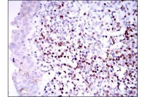 Immunohistochemistry (IHC) image for anti-Paired Box 5 (PAX5) (AA 235-382) antibody (ABIN1098104)