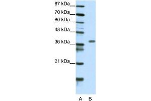 WB Suggested Anti-MEOX2 Antibody Titration:  2. (MEOX2 抗体  (N-Term))
