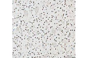 IHC analysis of SFPQ using anti-SFPQ antibody (ABIN7603089). (SFPQ 抗体  (Middle Region))