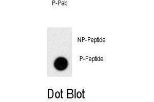 Dot blot analysis of anti-Phospho-PRL-p Antibody (ABIN389956 and ABIN2839758) on nitrocellulose membrane. (Prolactin 抗体  (pSer163))