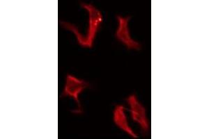 ABIN6276146 staining COLO205 by IF/ICC. (OR4A16 抗体  (C-Term))