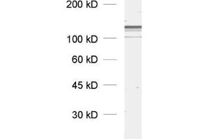 dilution: 1 : 1000, sample: rat brain homogenate (Dynamin 3 抗体  (AA 773-794))