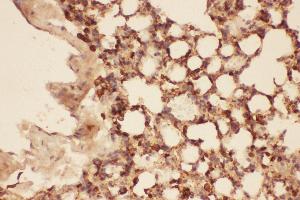 Anti-Cofilin Picoband antibody,  IHC(P): Mouse Lung Tissue (Cofilin 抗体  (AA 2-166))