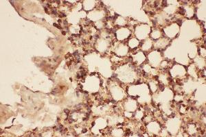 Anti-Cofilin Picoband antibody,  IHC(P): Mouse Lung Tissue (Cofilin 抗体  (AA 2-166))
