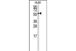 Western blot analysis of anti-CYP4Z1 Antibody in HL60 cell line lysates (35ug/lane).