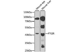 Western blot analysis of extracts of various cell lines, using PTGIR antibody. (Prostacyclin Receptor 抗体  (AA 207-386))