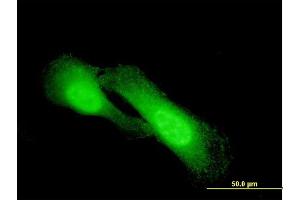Immunofluorescence of monoclonal antibody to NDRG1 on HeLa cell.