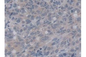 Immunohistochemistry (IHC) image for anti-Ras-related Protein Ral-A (rala) (AA 1-206) antibody (ABIN7428572)