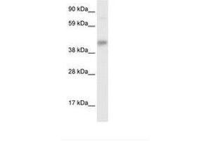 Image no. 1 for anti-SEC14-Like 2 (SEC14L2) (AA 245-294) antibody (ABIN6735907) (SEC14L2 抗体  (AA 245-294))