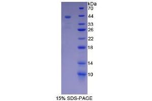 SDS-PAGE analysis of Rat Mucin 5B Protein. (MUC5B 蛋白)