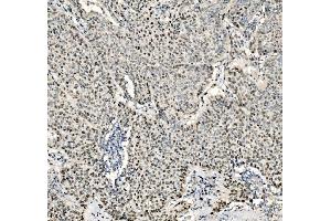 IHC analysis of JUNB using anti-JUNB antibody (ABIN7603223). (JunB 抗体  (N-Term))