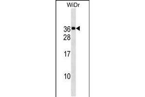 Western blot analysis in WiDr cell line lysates (35ug/lane). (MED30 抗体  (AA 107-133))