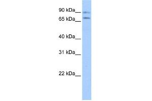 WB Suggested Anti-JPH2 Antibody Titration:  0. (Junctophilin 2 抗体  (Middle Region))