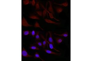 Immunofluorescence (IF) image for anti-Small Nuclear Ribonucleoprotein D1 Polypeptide 16kDa (SNRPD1) (AA 1-100) antibody (ABIN7270363)