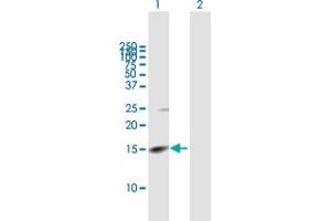 Western Blot analysis of RHBDL2 expression in transfected 293T cell line by RHBDL2 MaxPab polyclonal antibody. (RHBDL2 抗体  (AA 1-121))