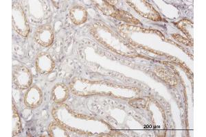 Immunoperoxidase of monoclonal antibody to CTSK on formalin-fixed paraffin-embedded human kidney. (Cathepsin K 抗体  (AA 220-329))