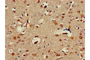 Immunohistochemistry of paraffin-embedded human brain tissue using ABIN7143961 at dilution of 1:100 (ALX1 抗体  (AA 10-304))
