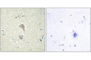 Immunohistochemistry analysis of paraffin-embedded human brain tissue, using NKTR Antibody. (NKTR 抗体  (AA 784-833))