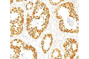 IHC staining of normal colon with p53 antibody (DO-7). (p53 抗体  (AA 20-25))