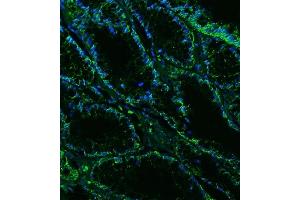 IF analysis of Claudin18/CLDN18 using anti-Claudin18/CLDN18 antibody (ABIN7601257). (Claudin 18 抗体  (AA 31-261))