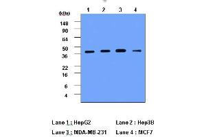 Western Blotting (WB) image for anti-Cathepsin D (CTSD) (AA 21-412) antibody (ABIN317502) (Cathepsin D 抗体  (AA 21-412))