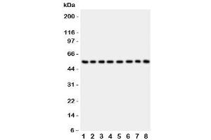 Western blot testing of P2X2 antibody and Lane 1:  rat brain (P2RX2 抗体  (AA 139-471))
