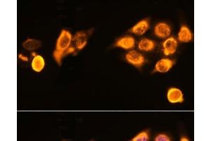 Immunofluorescence analysis of HeLa cells using ASPM Polyclonal Antibody at dilution of 1:100. (ASPM 抗体)