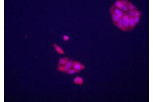 Immunofluorecence staining of GPC3 polyclonal antibody  on HepG2 cells . (Glypican 3 抗体  (AA 530-560))