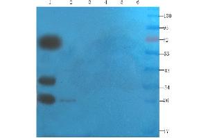 Western Blot using anti-SNAP25 antibody ABIN7072250 Mouse brain (lane 1), mouse rectum (lane 2), mouse pancreas (lane 3), human lung cancer (lane 4), human breast cancer (lane 5) and Hela cell(lane 6) samples were resolved on a 12 % SDS PAGE gel and blots probed with ABIN7072250 at 2 μg/mL before being detected by a secondary antibody. (Recombinant SNAP25 抗体)