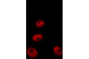 ABIN6267252 staining 293 by IF/ICC.